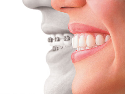 The image shows a split-screen comparison between an adult person s teeth and a younger person s teeth, with the adult teeth appearing worn and the younger teeth looking healthy and well-maintained.