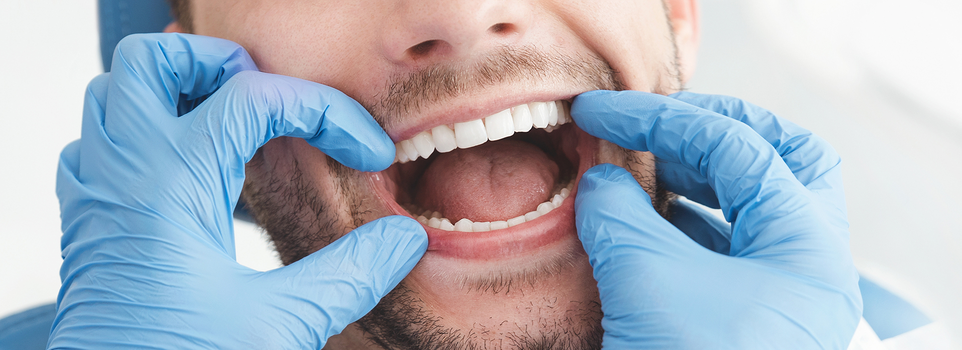 A dental professional with their hands covered in blue gloves holding up a patient s mouth open for examination.