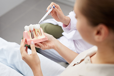 A woman in a dental office holding a model tooth while a dentist looks on.