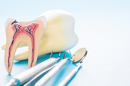 The image shows two close-up photographs side by side on the left, a dental model with a toothbrush and dental instruments on the right, an illustration of a tooth with a cavity and gum disease, alongside dental tools.